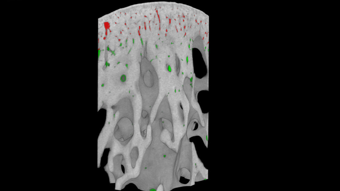 Blood vessels/nerves in bone